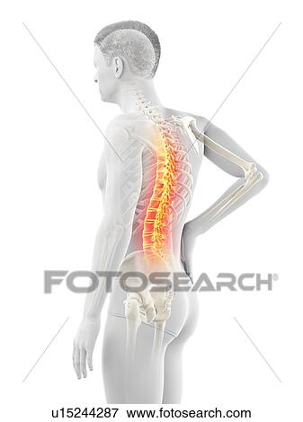 Back pain, conceptual illustration. View Large Photo Image Stock Photo - Back pain, conceptual illustration.. Fotosearch