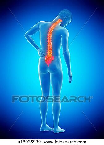 Back pain, conceptual illustration. View Large Photo Image Stock Photo - Back pain, conceptual illustration.. Fotosearch