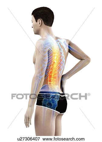 Stock Photo - Back pain, conceptual illustration.. Fotosearch