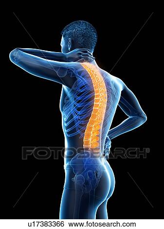 Back pain, conceptual illustration. View Large Photo Image Stock Photograph - Back pain, conceptual illustration.. Fotosearch