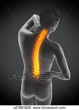 Back pain, conceptual illustration. View Large Photo Image Stock Photograph - Back pain, conceptual illustration.. Fotosearch