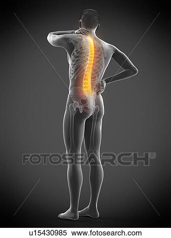 Stock Photography - Back pain, conceptual illustration.. Fotosearch