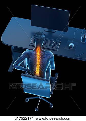 Picture - Back pain due to sitting, conceptual illustration.. Fotosearch
