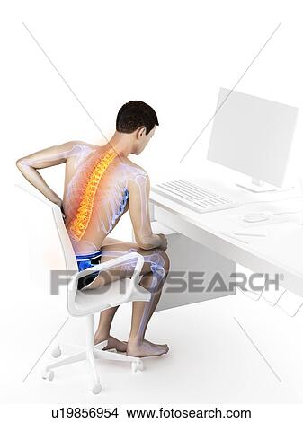 Picture - Back pain due to sitting, conceptual illustration.. Fotosearch