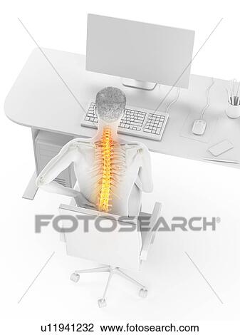 Stock Image - Back pain due to sitting, conceptual illustration.. Fotosearch