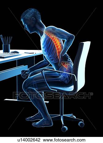 Stock Image - Back pain due to sitting, conceptual illustration.. Fotosearch