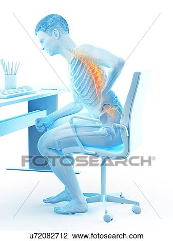 Back pain due to sitting, conceptual illustration. View Large Photo Image Stock Image - Back pain due to sitting, conceptual illustration.. Fotosearch