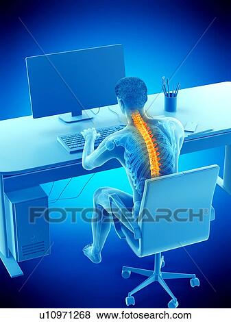 Stock Photo - Back pain due to sitting, conceptual illustration.. Fotosearch