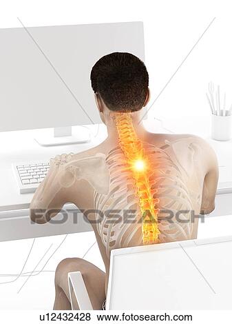 Back pain due to sitting, conceptual illustration. View Large Photo Image Stock Photo - Back pain due to sitting, conceptual illustration.. Fotosearch