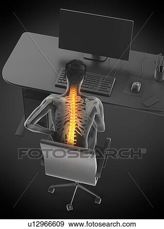 Stock Photo - Back pain due to sitting, conceptual illustration.. Fotosearch