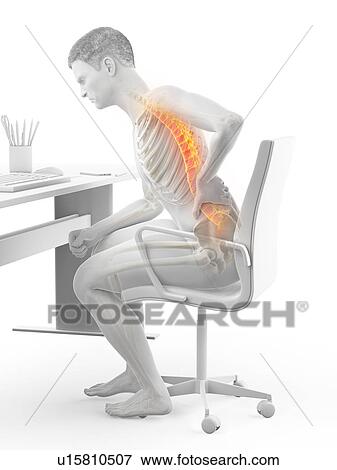 Stock Photo - Back pain due to sitting, conceptual illustration.. Fotosearch