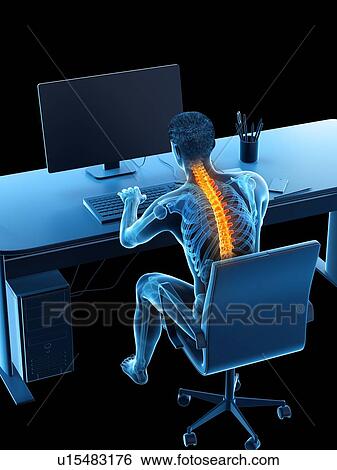 Stock Photograph - Back pain due to sitting, conceptual illustration.. Fotosearch