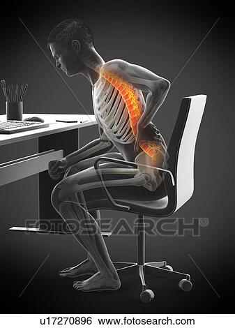 Stock Photograph - Back pain due to sitting, conceptual illustration.. Fotosearch