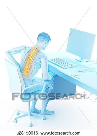 Stock Photograph - Back pain due to sitting, conceptual illustration.. Fotosearch