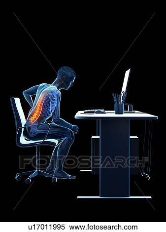 Stock Photography - Back pain due to sitting, conceptual illustration.. Fotosearch