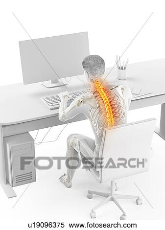 Stock Photography - Back pain due to sitting, conceptual illustration.. Fotosearch