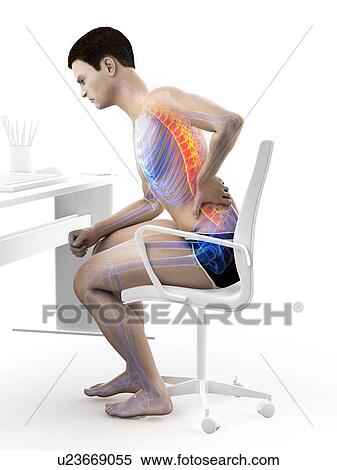 Stock Photography - Back pain due to sitting, conceptual illustration.. Fotosearch