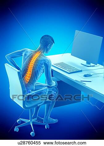 Stock Photography - Back pain due to sitting, conceptual illustration.. Fotosearch