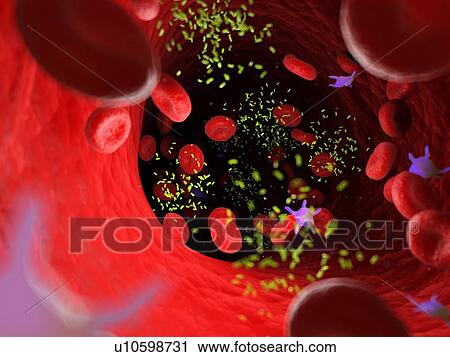 Stock Image - Bacteria in a blood vessel, computer illustration.. Fotosearch