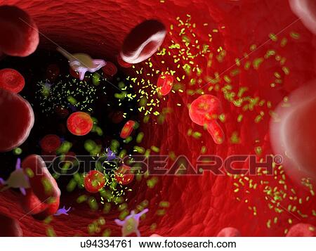 Stock Image - Bacteria in a blood vessel, computer illustration.. Fotosearch