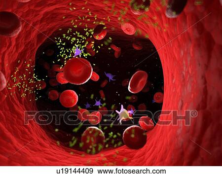 Stock Photo - Bacteria in a blood vessel, computer illustration.. Fotosearch