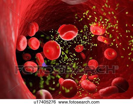Stock Photograph - Bacteria in a blood vessel, computer illustration.. Fotosearch