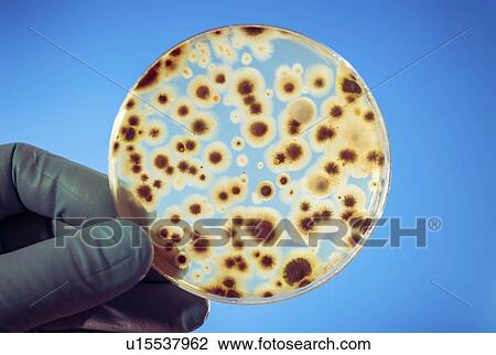 Stock Image - Bacteria on petri dish.. Fotosearch