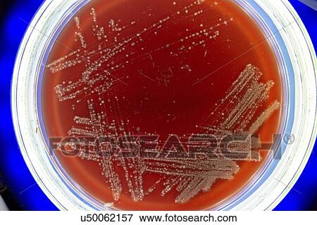 Stock Photo - Bacteria on petri dish.. Fotosearch