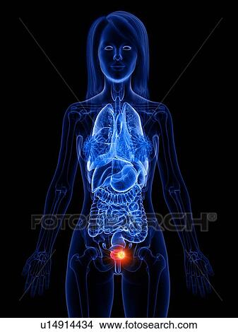 Picture - Bladder cancer, conceptual illustration. Fotosearch