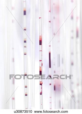 Stock Image - Blood passing through tubes during processing.. Fotosearch