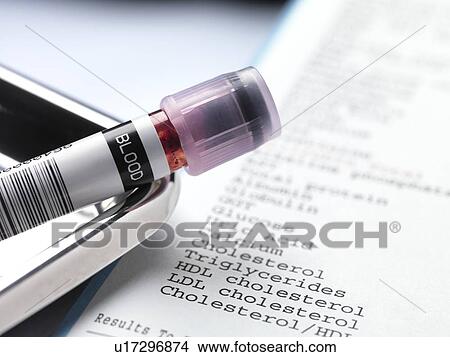 Blood sample and test results. View Large Photo Image Picture - Blood sample and test results.. Fotosearch