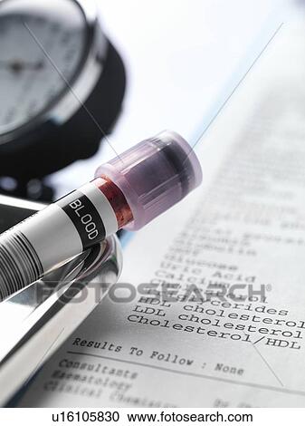Stock Image - Blood sample and test results.. Fotosearch