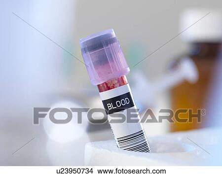 Blood sample awaiting testing. View Large Photo Image Picture - Blood sample awaiting testing.. Fotosearch