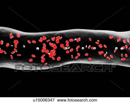 Stock Photo - Blood vessel, computer illustration.. Fotosearch