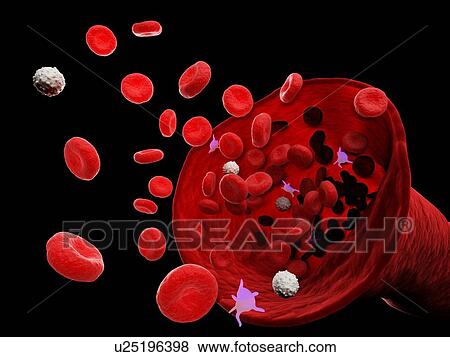 Stock Photo - Blood vessel, computer illustration.. Fotosearch