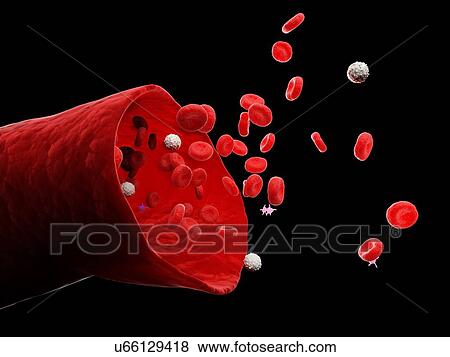Stock Photo - Blood vessel, computer illustration.. Fotosearch
