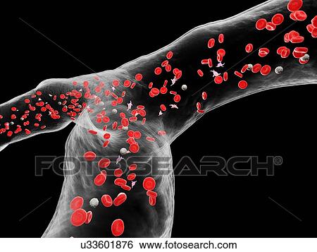 Blood vessel, computer illustration. View Large Photo Image Stock Photograph - Blood vessel, computer illustration.. Fotosearch