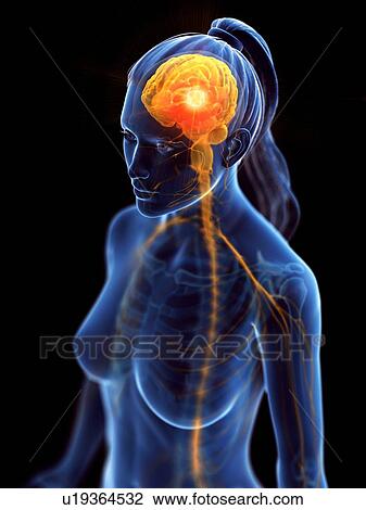 Stock Image - Brain cancer, conceptual computer illustration.. Fotosearch