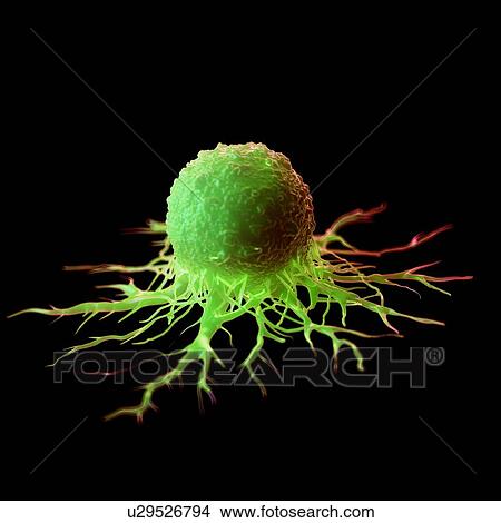 Picture - Cancer cell, computer illustration.. Fotosearch