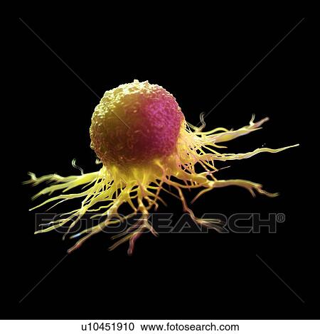 Stock Image - Cancer cell, computer illustration.. Fotosearch