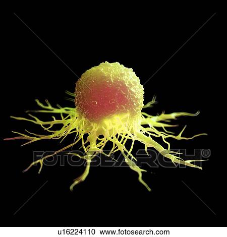 Stock Image - Cancer cell, computer illustration.. Fotosearch