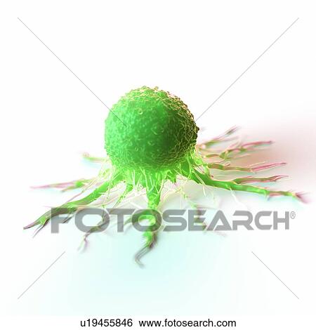 Stock Photograph - Cancer cell, computer illustration.. Fotosearch