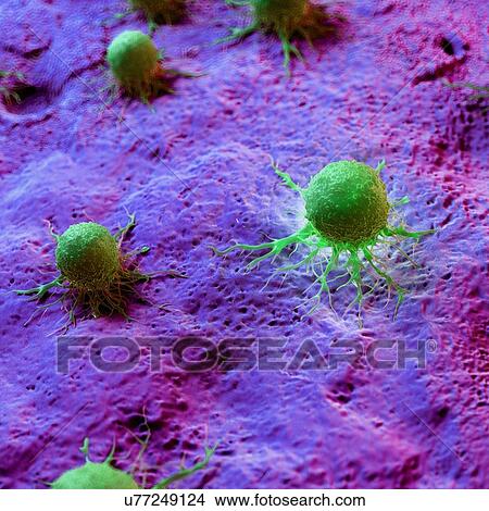 Picture - Cancer cells, computer illustration.. Fotosearch