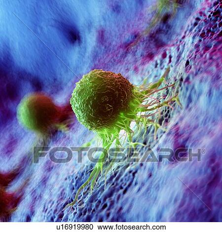 Stock Image - Cancer cells, computer illustration.. Fotosearch