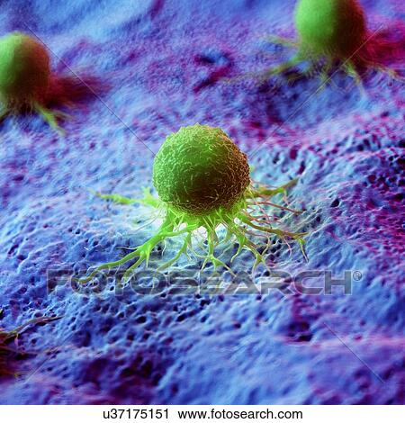 Stock Image - Cancer cells, computer illustration.. Fotosearch