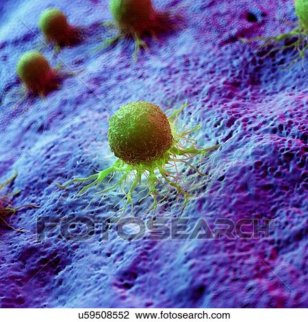 Cancer cells, computer illustration. View Large Photo Image Stock Image - Cancer cells, computer illustration.. Fotosearch
