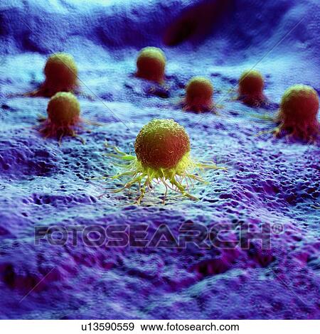 Cancer cells, computer illustration. View Large Photo Image Stock Photo - Cancer cells, computer illustration.. Fotosearch