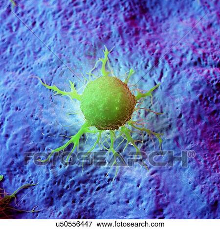 Cancer cells, computer illustration. View Large Photo Image Stock Photo - Cancer cells, computer illustration.. Fotosearch