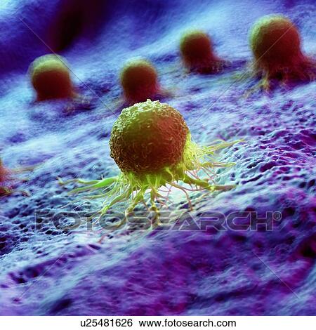Cancer cells, computer illustration. View Large Photo Image Stock Photograph - Cancer cells, computer illustration.. Fotosearch
