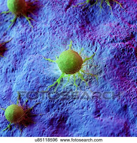 Stock Photograph - Cancer cells, computer illustration.. Fotosearch